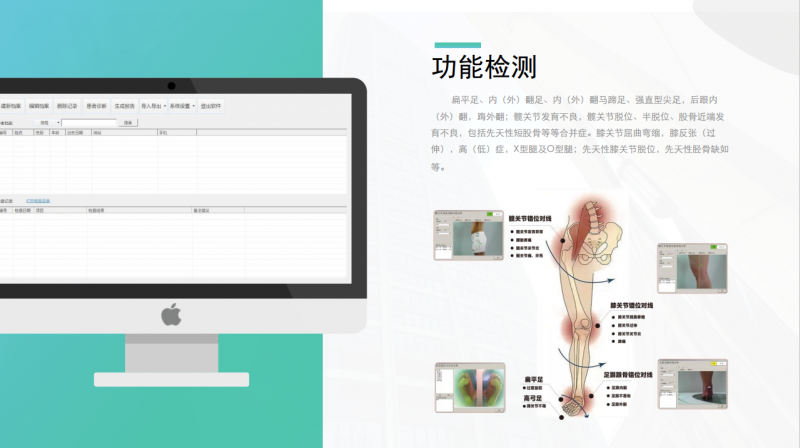 下肢關(guān)節(jié)對線及足底壓力分布檢測設(shè)備-
