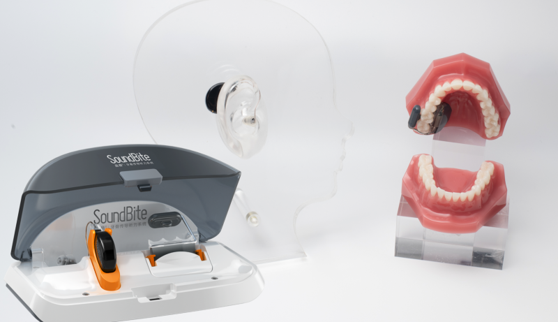 品音®SoundBite®牙骨傳導(dǎo)聽力系統(tǒng)-