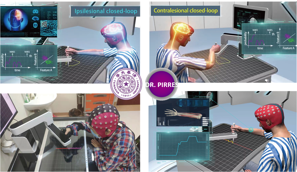 智能精準(zhǔn)康復(fù)機器人專家系統(tǒng)