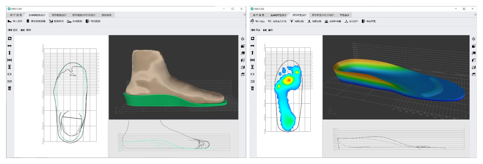 矯形鞋墊快速設(shè)計軟件